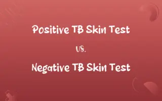 Positive TB Skin Test vs. Negative TB Skin Test